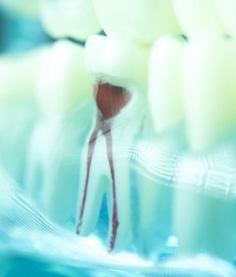 Model of tooth showing nerve pathways