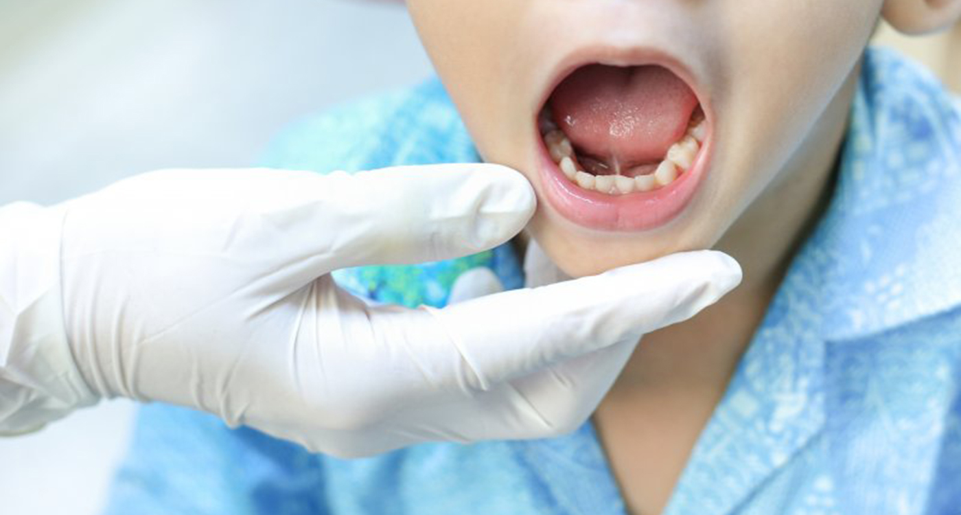 a child receiving dental care from his dentist